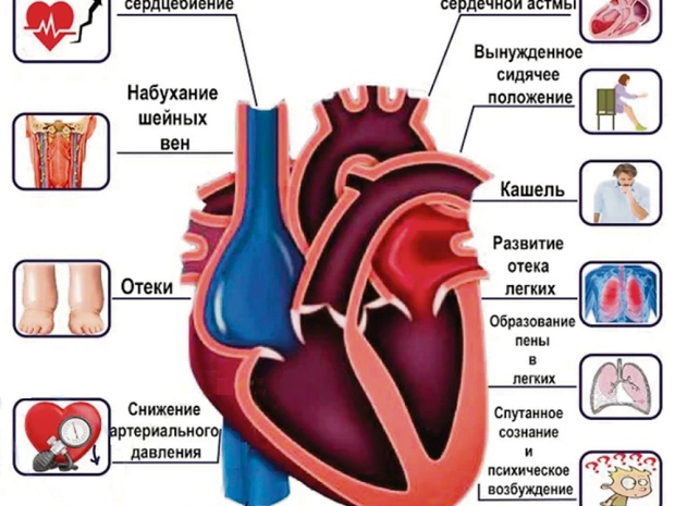 Сердечная слабость